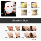 Made in Korea LED Face Mask Light Therapy LED MASK Red Light IR Photon Skin Rejuvenation[673]