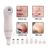 Diamond Microdermabrasion Facial Skin Care Beauty Device [193]