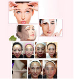 HIFU Ultrasonic Mini RF Facial Lifting Skin LED Rejuvenation Therapy Beauty Device [814]