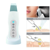Ultrasonic Ultrasound Vibration Skin Facial Lifting Cleaning Scrubber Beauty Device [845]