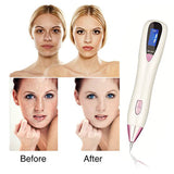 Beauty Device Laser Mole Freckle Warts Remover Skin Tag Tattoo Removal Pen  [954]